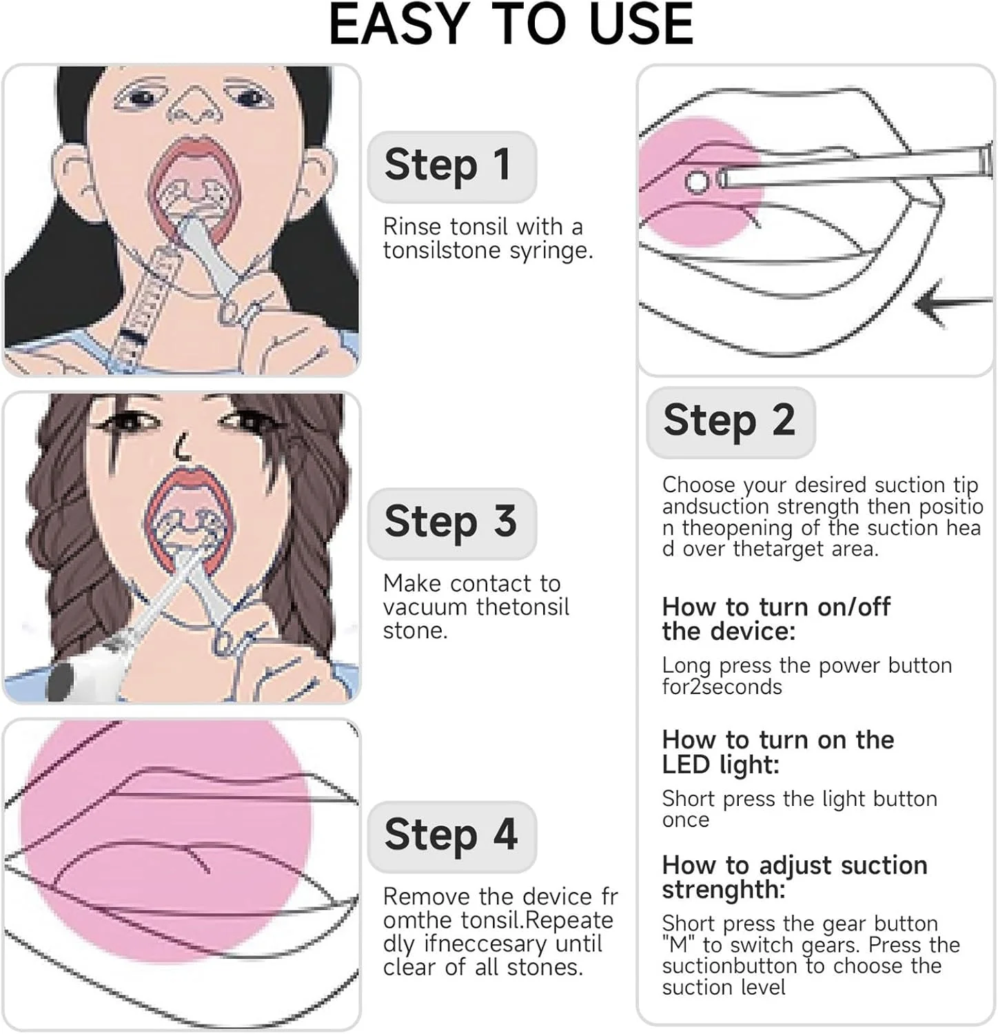 کیت حذف کننده سنگ لوزه، کیت حذف الکترونیکی سنگ لوزه با مکش و همراه با سرنگ شستشوی دهان، آبسلانگ و آینه بزرگنمایی 5 برابر (B)
