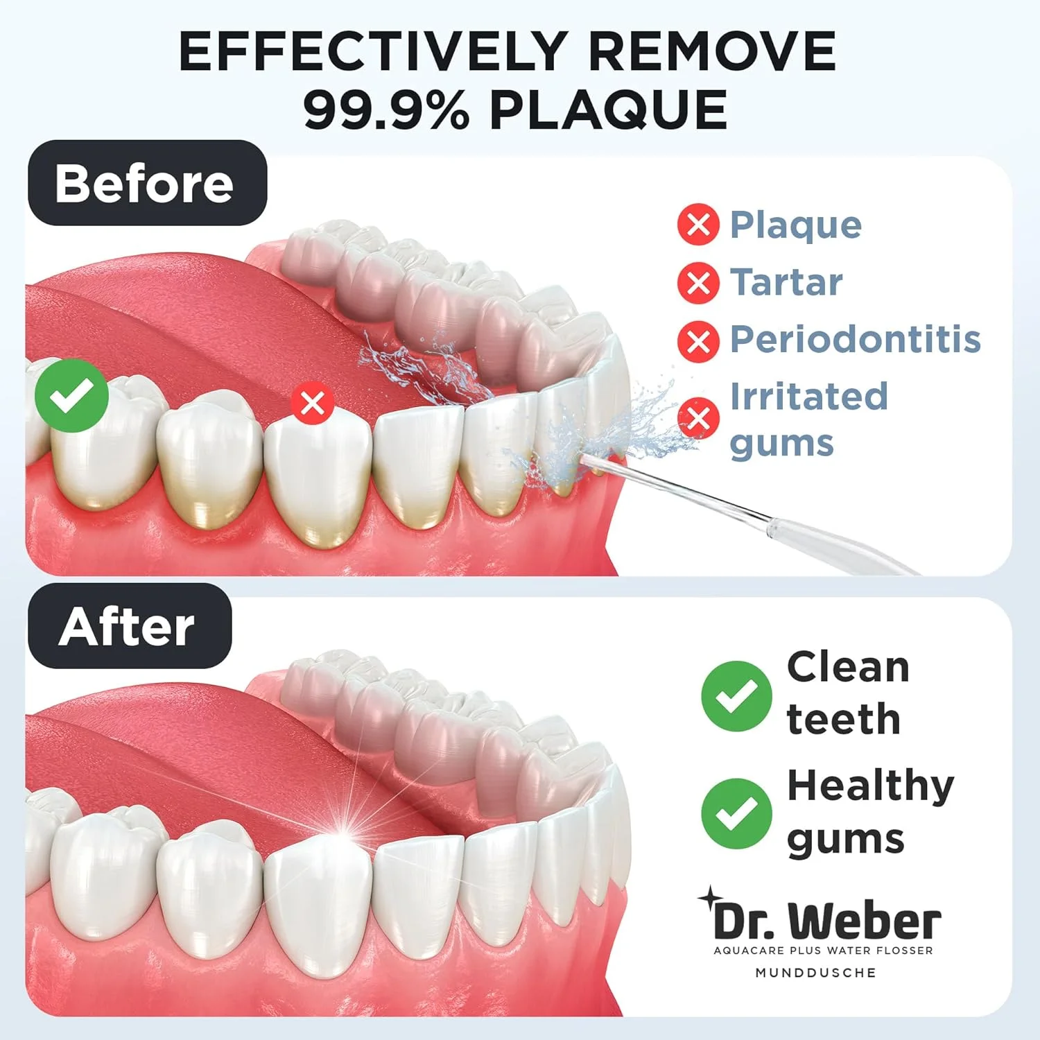 آب‌فشان دهانی پارا هلث دکتر وبر آکواکر، فناوری آکواکر پزشکی برای مراقبت بهینه از لثه و دندان، تمیز کننده بین دندانی با 4 حالت و 4 نازل (مشکی، بسته 1 عددی)