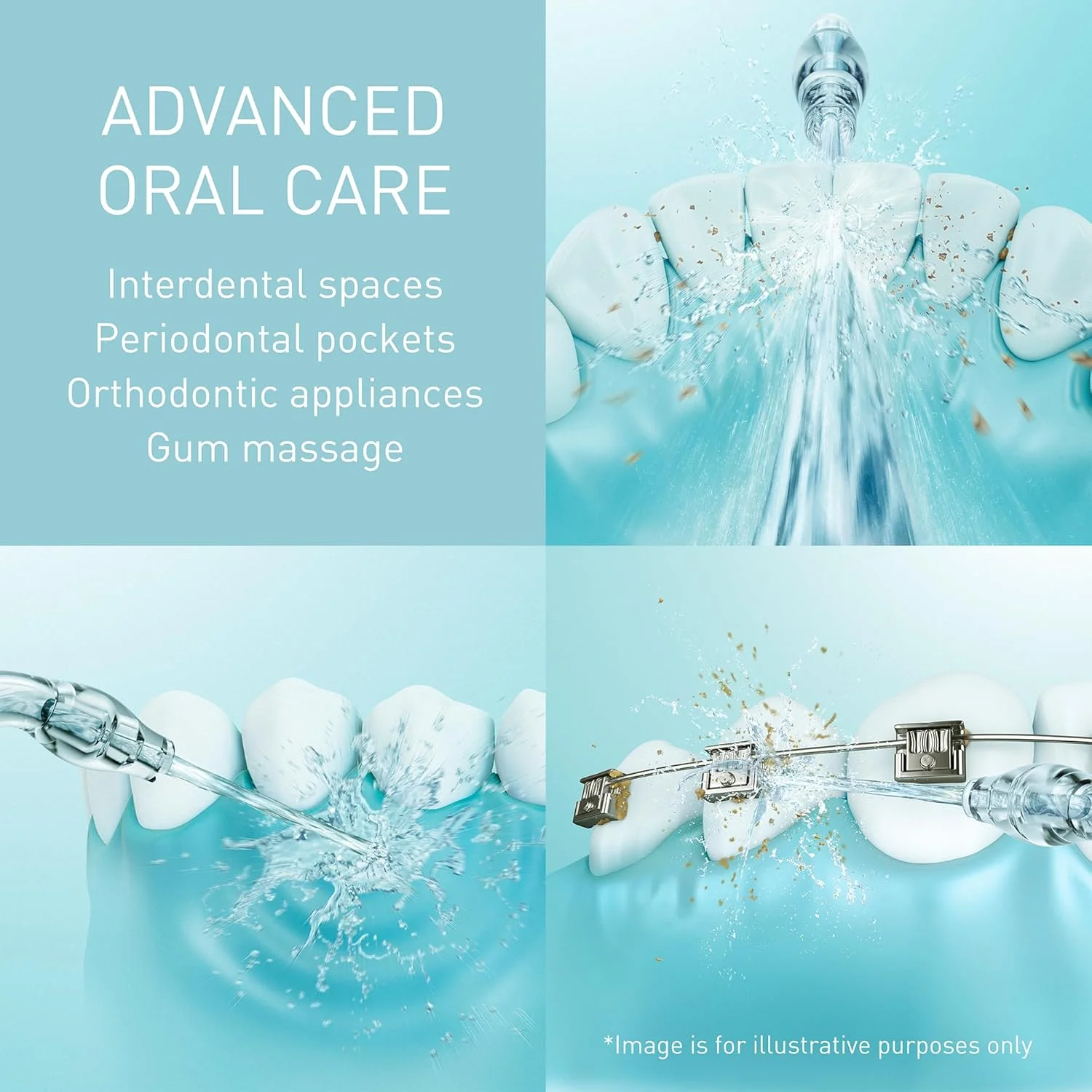 دستگاه شستشوی دهان و دندان پاناسونیک مدل EW1614AW503-PACK، جت التراسونیک، حالت کودک، 10 تنظیم فشار، IPX7، مناسب ارتودنسی، 5 نازل، منبع تغذیه برق، سفید