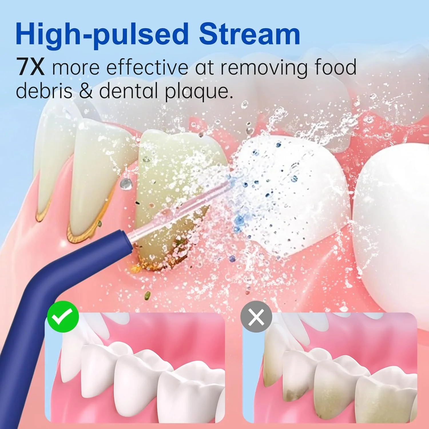 دستگاه پاک کننده دندان با آب: نخ دندان آبی شارژی بی سیم - 4 حالت ضد آب IPX7، مخزن جداشدنی 300 میلی لیتری، دستگاه برقی نخ دندان برای ارتودنسی، مسافرت و استفاده در منزل (آبی تیره)