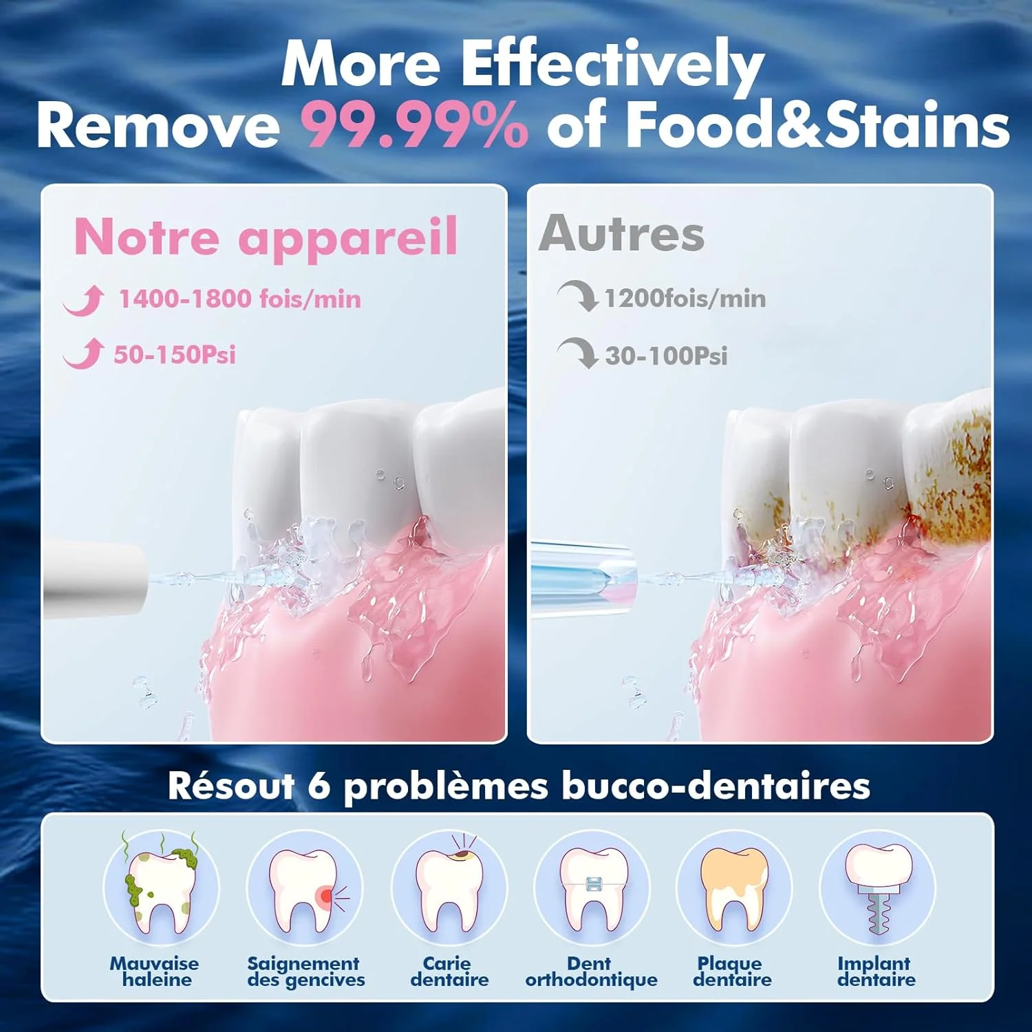 واترجت دهانی برقی بی سیم WAFLOO، نخ دندان آبی قابل حمل با 5 حالت و 4 نازل جت، مخزن آب 300 میلی لیتری، ضد آب IPX7، برنده تست 2025 برای ایمپلنت، خانواده ها و مسافرت