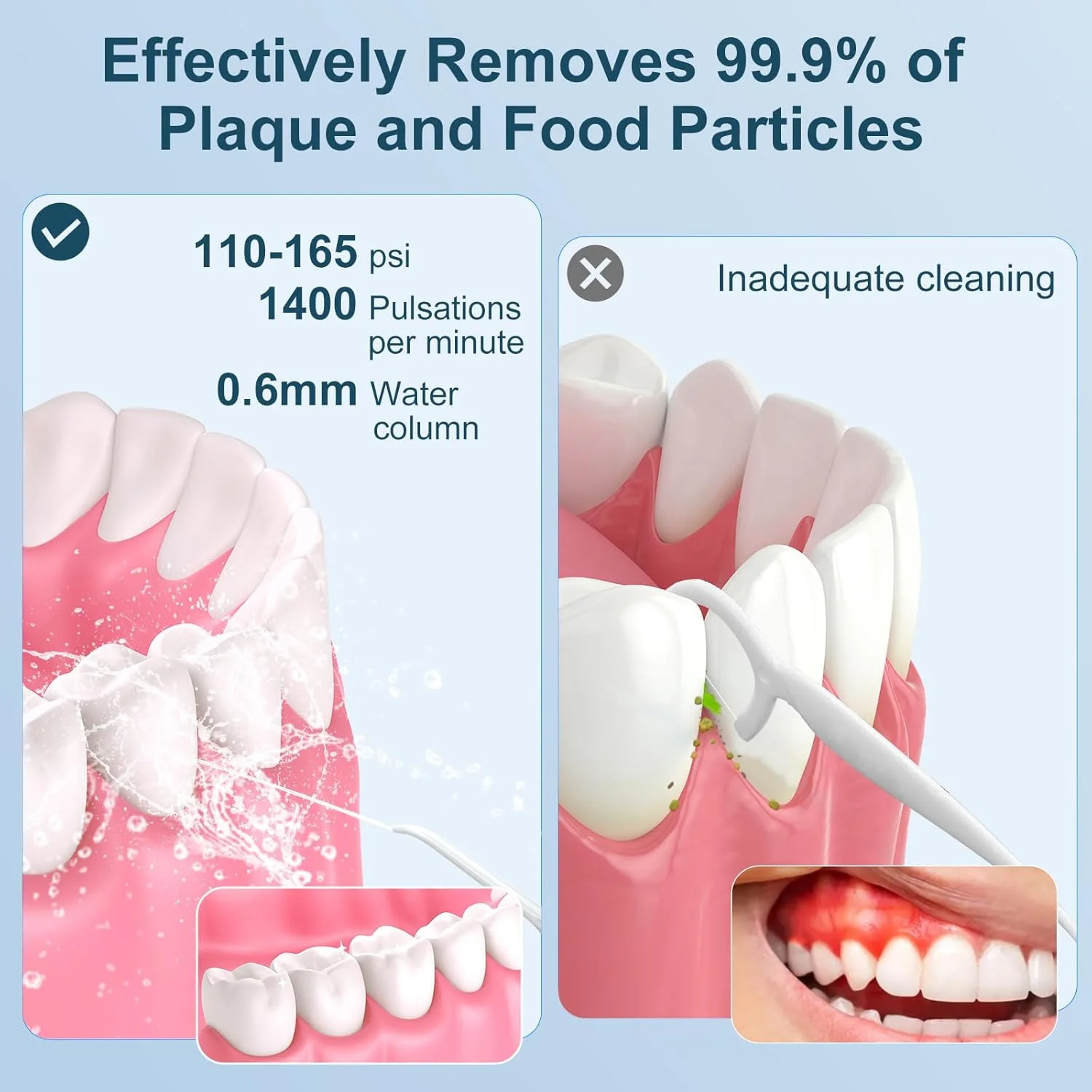 دستگاه نخ دندان آبی بی سیم ZDMATHE با ظرفیت 300 میلی لیتر - دستگاه نخ دندان آبی مسافرتی قابل شارژ برای تمیز کردن دندان با 5 تنظیم فشار، 4 سری، ضد آب IPX7 برای تمیز کردن دندان