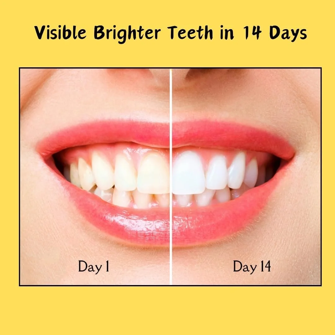 نوارهای سفید کننده دندان 4Smiles | از بین برنده لکه های دندان | با قدرت PAP+ | بدون پراکسید و حساسیت | کیت سفید کننده دندان برای آقایان و بانوان | وگان | 28 نوار (14 بار استفاده) نوارهای سفید کننده دندان 4Smiles | از بین برنده لکه های دندان | با قدرت PAP+ | بدون پراکسید و حساسیت | کیت سفید کننده دندان برای آقایان و بانوان | وگان | 28 نوار (14 بار استفاده)