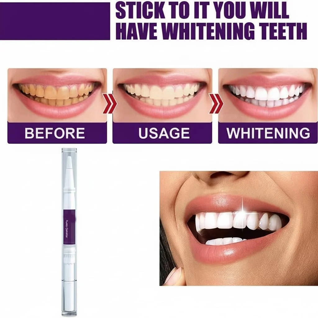 قلم سفید کننده دندان آزونی، 4 عدد قلم بنفش اصلاح کننده رنگ دندان، پاک کننده لکه دندان، ژل سفید کننده دندان، سفید کننده دندان، طعم نعناع طبیعی، لبخند سفید زیبا قلم سفید کننده دندان آزونی، 4 عدد قلم بنفش اصلاح کننده رنگ دندان، پاک کننده لکه دندان، ژل سفید کننده دندان، سفید کننده دندان، طعم نعناع طبیعی، لبخند سفید زیبا