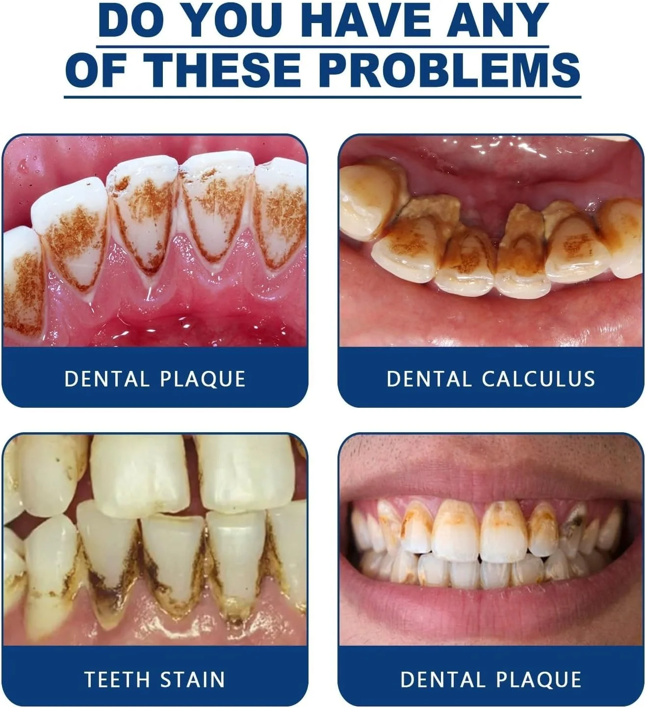 اسپری پاک کننده جرم دندان، از بین برنده طولانی مدت و طراوت بخش جرم دندان - پاک کننده پلاک دندان، اسپری سفید کننده دندان، اسپری ضد بوی بد دهان (30 میلی لیتر) اسپری پاک کننده جرم دندان، از بین برنده طولانی مدت و طراوت بخش جرم دندان - پاک کننده پلاک دندان، اسپری سفید کننده دندان، اسپری ضد بوی بد دهان (30 میلی لیتر)