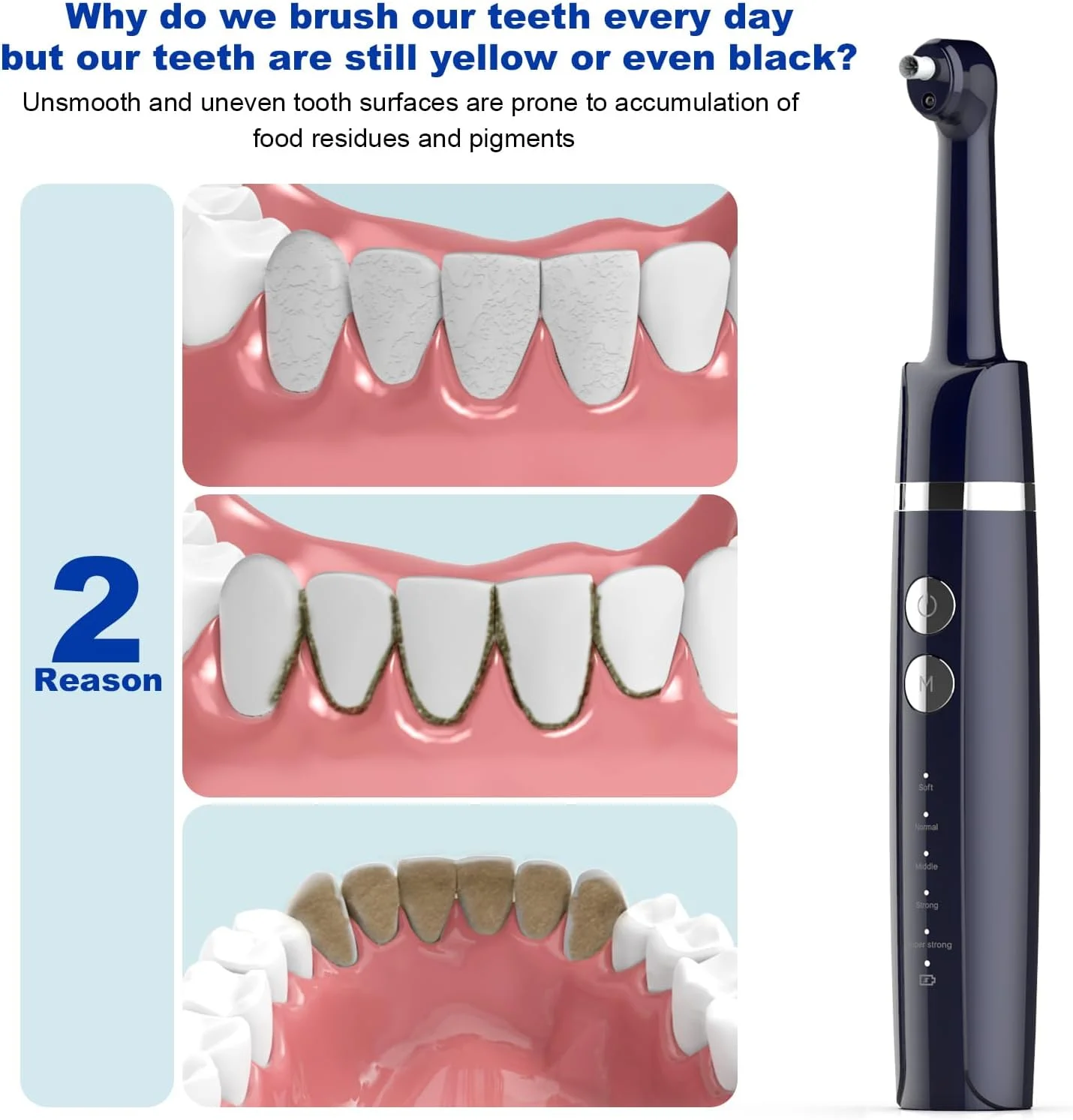 دستگاه پولیش دندان، کیت پولیش دندان، 6 سری، 5 حالت سرعت، چراغ LED، شامل خمیر دندان حرفه ای، قابل شارژ USB، سفید کننده، 1 عدد دستگاه پولیش دندان، کیت پولیش دندان، 6 سری، 5 حالت سرعت، چراغ LED، شامل خمیر دندان حرفه ای، قابل شارژ USB، سفید کننده، 1 عدد