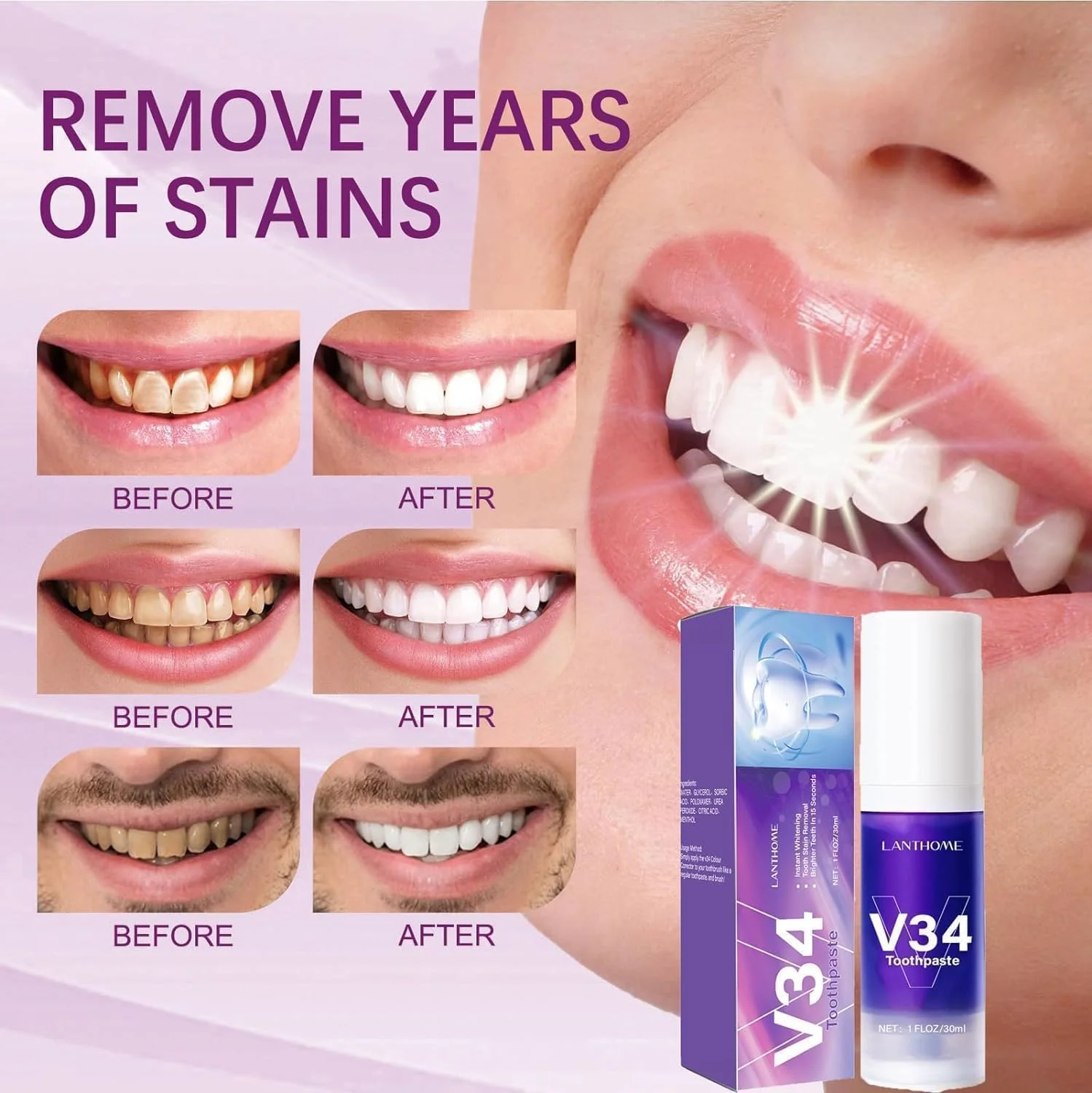 V34 اصلاح رنگ، خمیر دندان بنفش روشن کننده دندان، 2 عدد، خمیر دندان اصلاح کننده رنگ روشن کننده دندان، دندان های سفید، خمیر دندان بنفش برای از بین بردن جرم، خمیر دندان سفید کننده دندان برای دندان های زرد V34 اصلاح رنگ، خمیر دندان بنفش روشن کننده دندان، 2 عدد، خمیر دندان اصلاح کننده رنگ روشن کننده دندان، دندان های سفید، خمیر دندان بنفش برای از بین بردن جرم، خمیر دندان سفید کننده دندان برای دندان های زرد