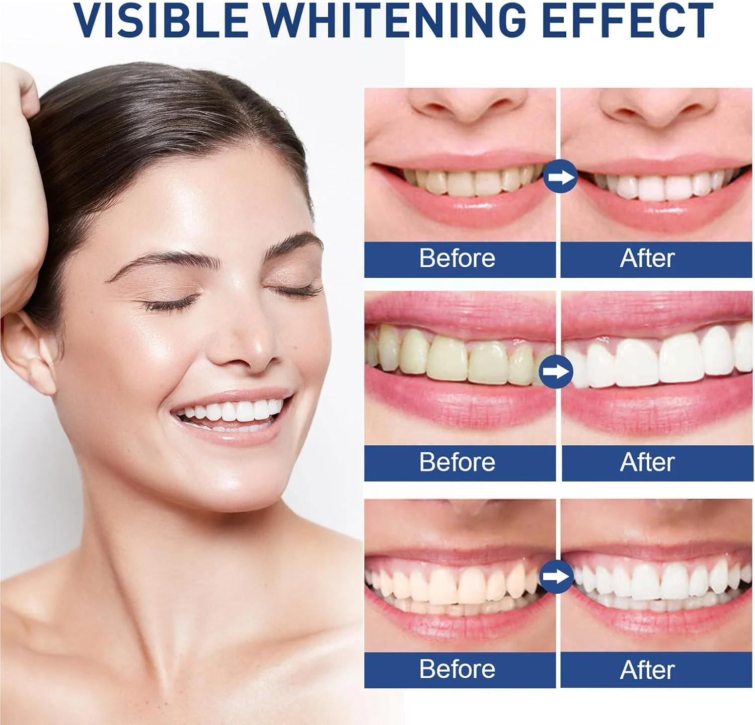 قلم سفید کننده دندان، سفید کننده فوری دندان، سفید کننده دهان، سفید کننده دندان با نور