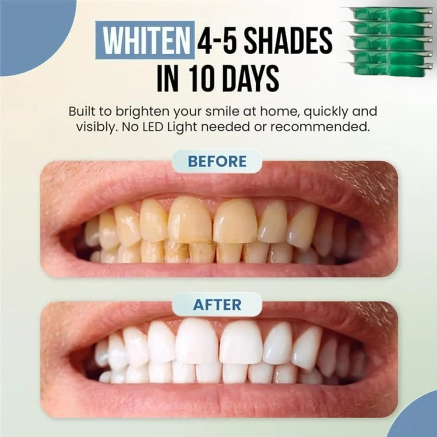 سینی های سفید کننده دندان Neutrava، سینی دهانی سفید کننده دندان، سینی های سفید کننده، طعم نعناع، نرم و راحت، طراوت بخش و روشن کننده، برای انواع دندان، کمک به روشن و تازه شدن لبخند شما