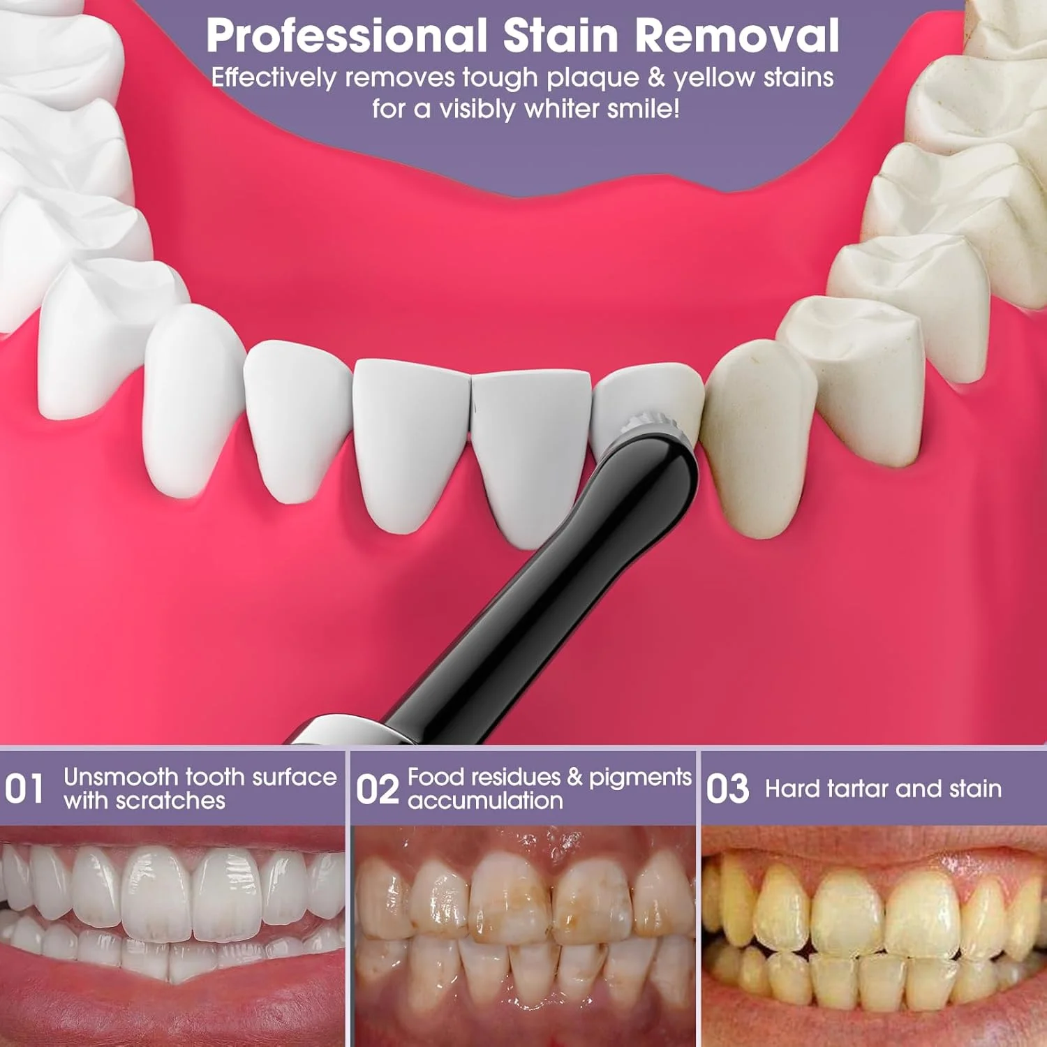 دستگاه پولیش دندان هانگسان، از بین برنده پلاک برای سفید کردن دندان، پاک کننده دندان برای تمیز کردن دندان و از بین بردن پلاک، از بین برنده لکه های زرد دندان با 5 سری برس، مشکی