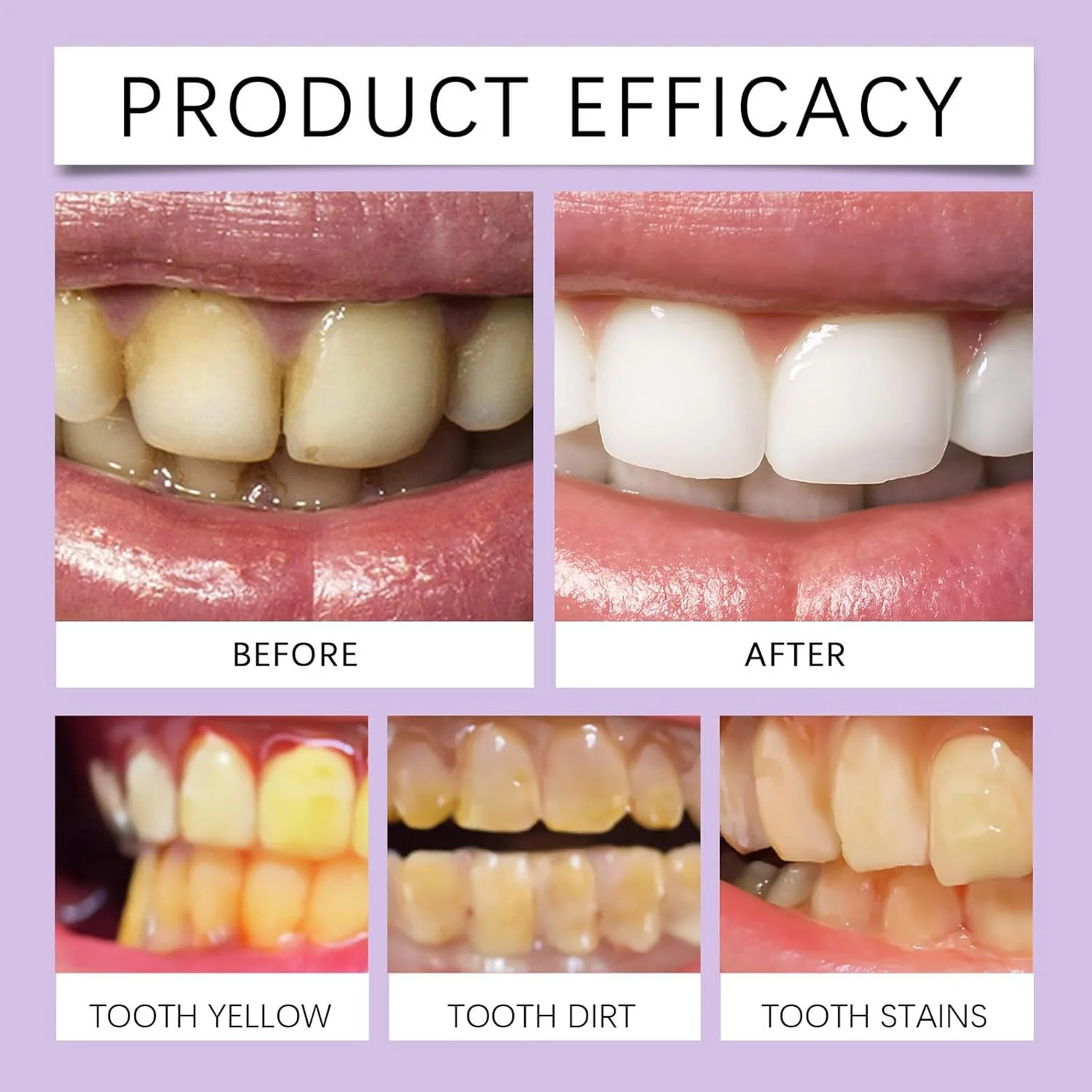 پودر تمیز کننده دندان، پودر تمیز کننده دهان برای دندان های درخشان تر - 50 گرم. لذت بردن از لبخند مطمئن. راه حل طبیعی و ملایم برای زنان، مردان، نوجوانان و بزرگسالان. مناسب برای سفر، خوابگاه و هتل