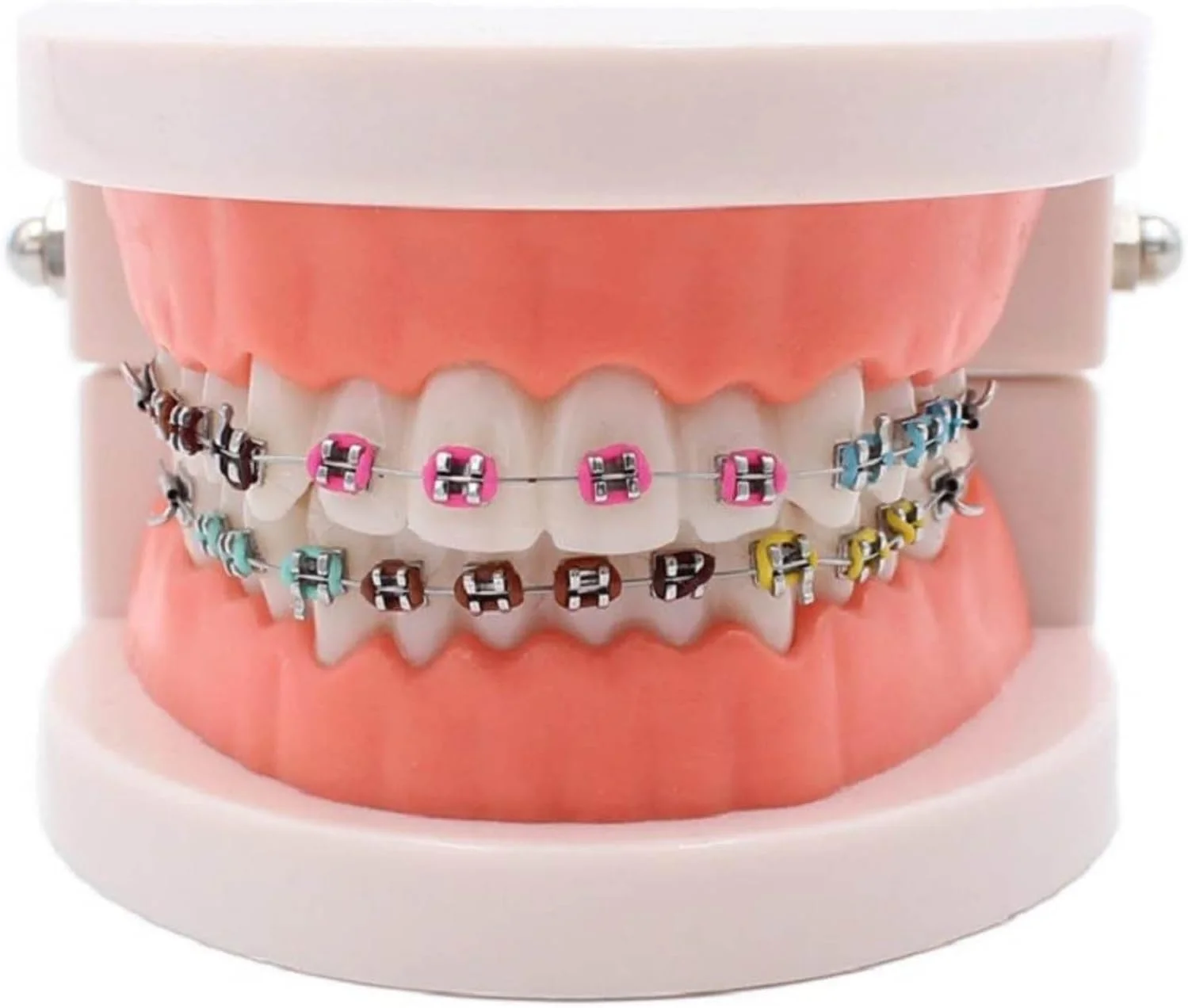 مدل دندانپزشکی ارتودنسی، مدل دندانپزشکی با ساپورت فلزی، قوس ساپورت فلزی خود-لیگاتور، برای توضیحات ارتودنسی و نمایش، طبیعی