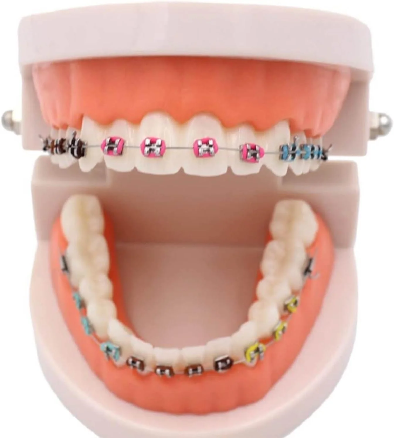 مدل دندانپزشکی ارتودنسی، مدل دندانپزشکی با ساپورت فلزی، قوس ساپورت فلزی خود-لیگاتور، برای توضیحات ارتودنسی و نمایش، طبیعی