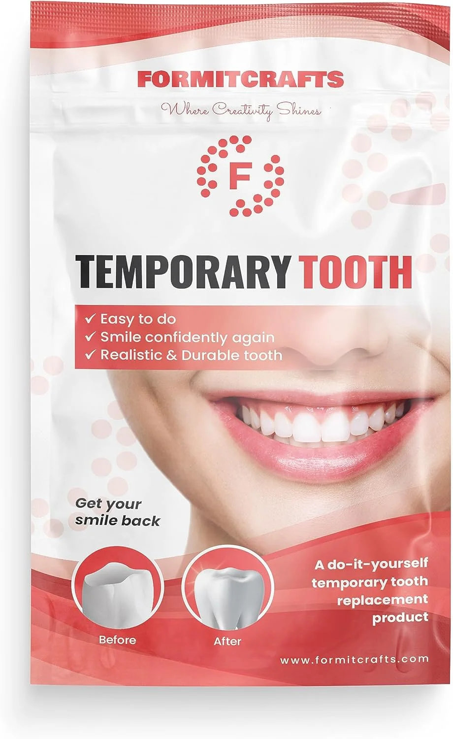 مهره های ترموپلاستیک Formit Crafts برای ترمیم دندان (105 گرم) مهره های حرارتی قالب پذیر برای ترمیم دندان - دندان های ترک خورده - واقعی و بادوام
