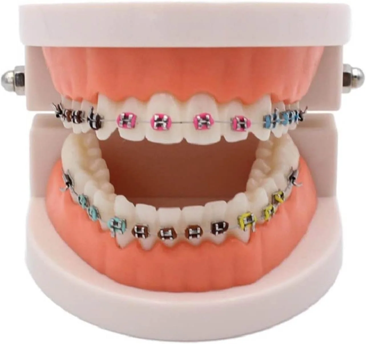 مدل دندانپزشکی ارتودنسی، مدل دندانپزشکی با ساپورت فلزی، قوس ساپورت فلزی خود-لیگاتور، برای توضیحات ارتودنسی و نمایش، طبیعی