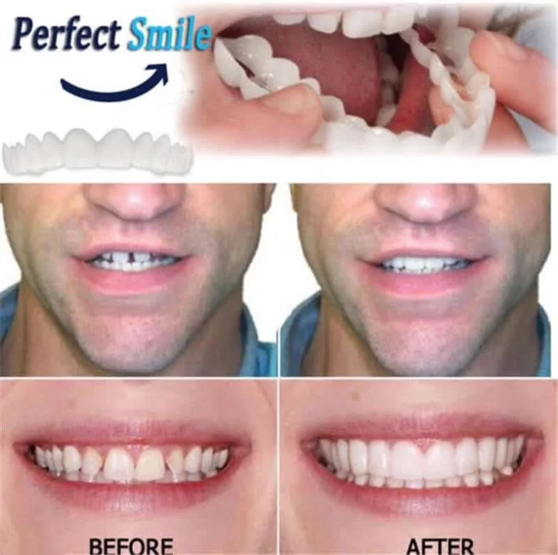 پوشش دندان مصنوعی بالا و پایین Gonaar Perfect Smile، فیت راحت، دندان مصنوعی آرایشی قابل استفاده مجدد، اصلاح فوری لبخند برای ردیف دوتایی، همراه با جعبه نگهداری پوشش دندان مصنوعی بالا و پایین Gonaar Perfect Smile، فیت راحت، دندان مصنوعی آرایشی قابل استفاده مجدد، اصلاح فوری لبخند برای ردیف دوتایی، همراه با جعبه نگهداری