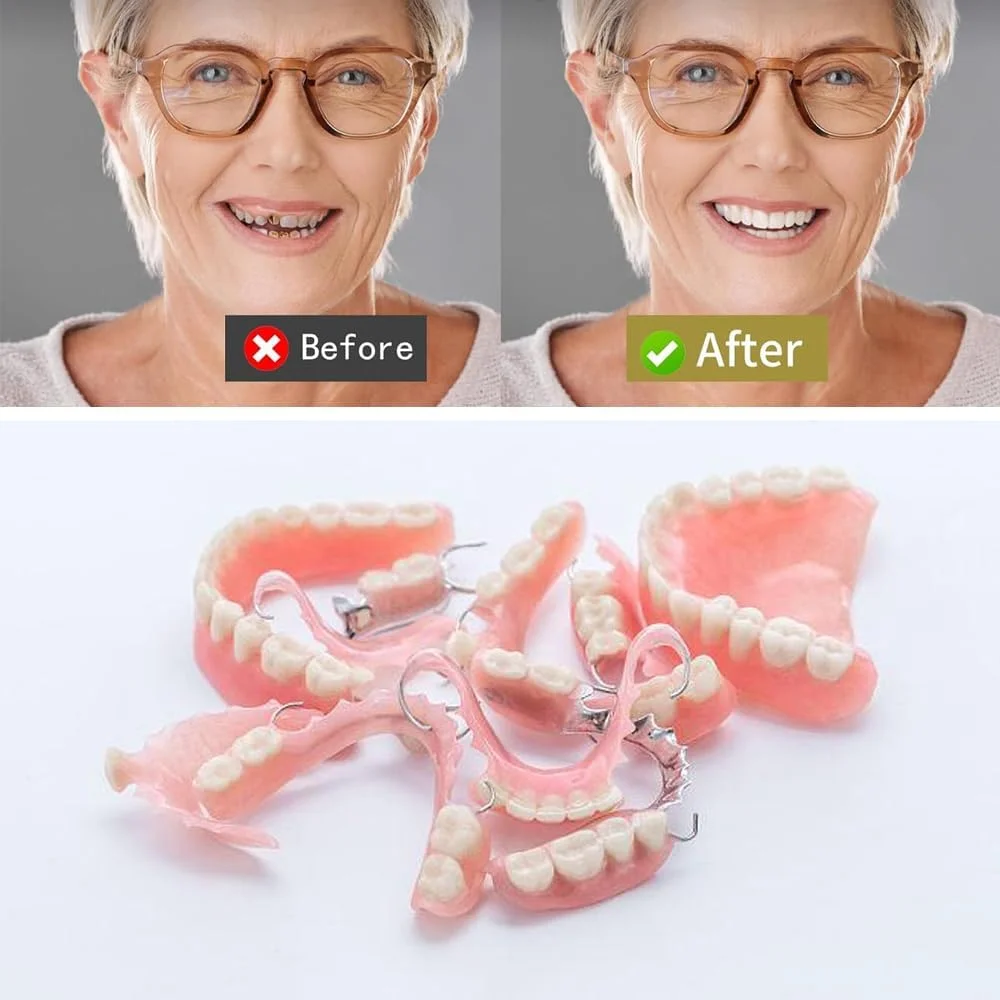 مواد لثه - برای ترمیم دندان های از دست رفته و بهبود لبخند. قطعات پروتزهای جزئی یا کامل