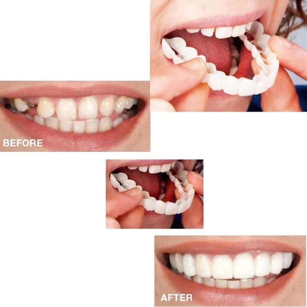 پوشش دندان مصنوعی بالا و پایین Gonaar Perfect Smile، فیت راحت، دندان مصنوعی آرایشی قابل استفاده مجدد، اصلاح فوری لبخند برای ردیف دوتایی، همراه با جعبه نگهداری پوشش دندان مصنوعی بالا و پایین Gonaar Perfect Smile، فیت راحت، دندان مصنوعی آرایشی قابل استفاده مجدد، اصلاح فوری لبخند برای ردیف دوتایی، همراه با جعبه نگهداری