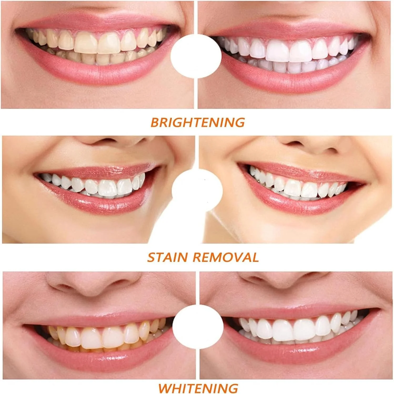 لاک دندان Celsky Smile، لاک سفید کننده فوری دندان، لاک سفید کننده طبیعی دندان، سفید کننده ماندگار، بدون حساسیت، استفاده سریع و آسان، روشن کننده (2 عدد)