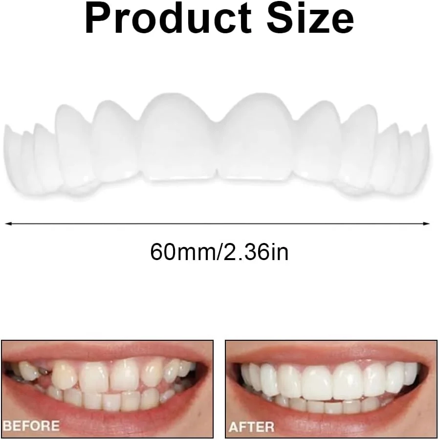 دندان مصنوعی HNJUSR، 1 جفت دندانپزشکی موقت، روکش دندان، دندان مصنوعی موقت بالا و پایین، لبخند بی نقص دندانی، با جعبه نگهداری برای مردان و زنان دندان مصنوعی HNJUSR، 1 جفت دندانپزشکی موقت، روکش دندان، دندان مصنوعی موقت بالا و پایین، لبخند بی نقص دندانی، با جعبه نگهداری برای مردان و زنان