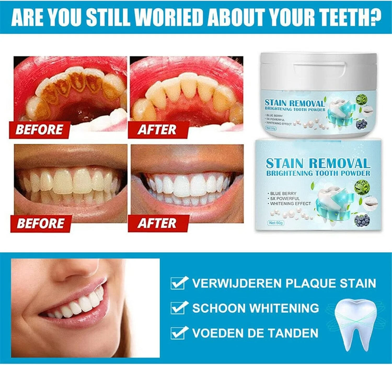 پودر دندان حاوی جوش شیرین، از بین برنده قوی لکه های دندان، پودر سفید کننده دندان، به طور موثر لکه های دندان را از بین می برد و تنفس را تازه می کند. بدون آسیب به مینای دندان یا لثه، 50 گرم (1 عدد)