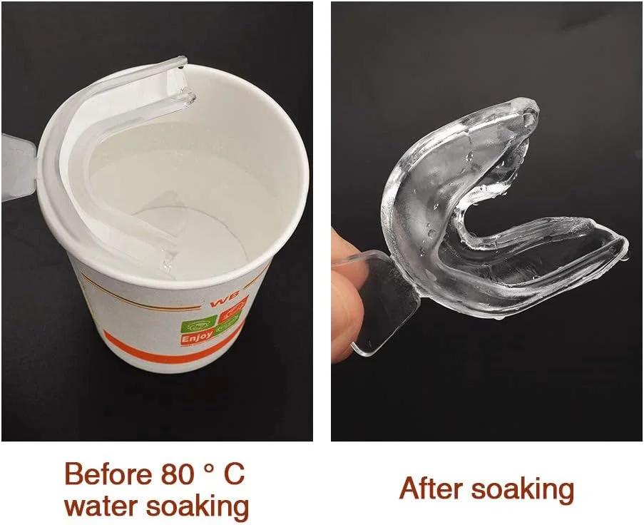 ۵ عدد قالب حرارتی دهانی دندانپزشکی برای سفید کردن دندان، سینی های سفید کننده دندان، محافظ دهان، مراقبت از بهداشت دهان ۵ عدد قالب حرارتی دهانی دندانپزشکی برای سفید کردن دندان، سینی های سفید کننده دندان، محافظ دهان، مراقبت از بهداشت دهان