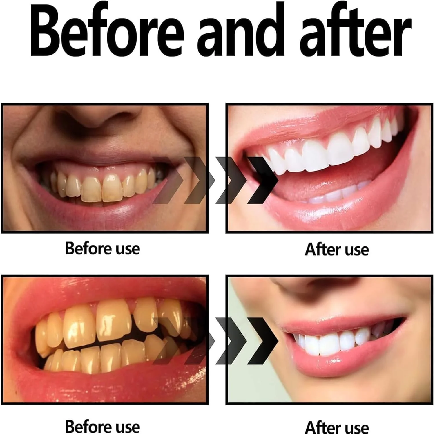 پودر سفید کننده طبیعی دندان KASTWAVE، پودر سفید کننده طبیعی دندان، پودر سفید کننده طبیعی دندان با نارگیل فعال، تمیز کننده عمیق دندان (2 عدد)