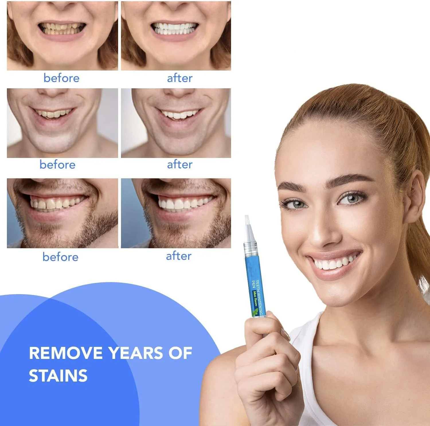 قلم سفید کننده دندان خزنا، بسته 2 عددی، اسانس پاک کننده لکه دندان، کیت سفید کننده دندان دلوکس، حذف سریع و موثر لکه دندان (طعم نعناع طبیعی) قلم سفید کننده دندان خزنا، بسته 2 عددی، اسانس پاک کننده لکه دندان، کیت سفید کننده دندان دلوکس، حذف سریع و موثر لکه دندان (طعم نعناع طبیعی)