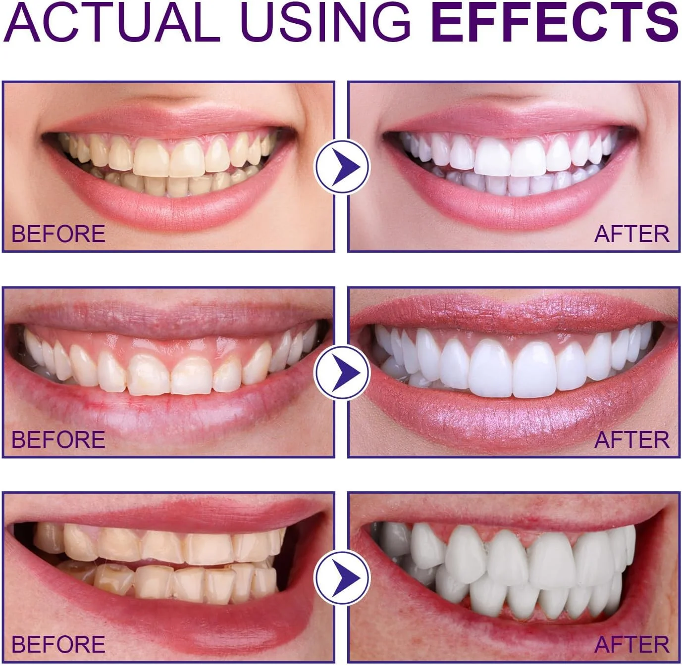 پودر درخشان سفید کننده و تمیز کننده دندان، پودر سفید کننده حرفه ای، پودر دندان معدنی، از بین برنده لکه های قدیمی، 30 گرم پودر درخشان سفید کننده و تمیز کننده دندان، پودر سفید کننده حرفه ای، پودر دندان معدنی، از بین برنده لکه های قدیمی، 30 گرم