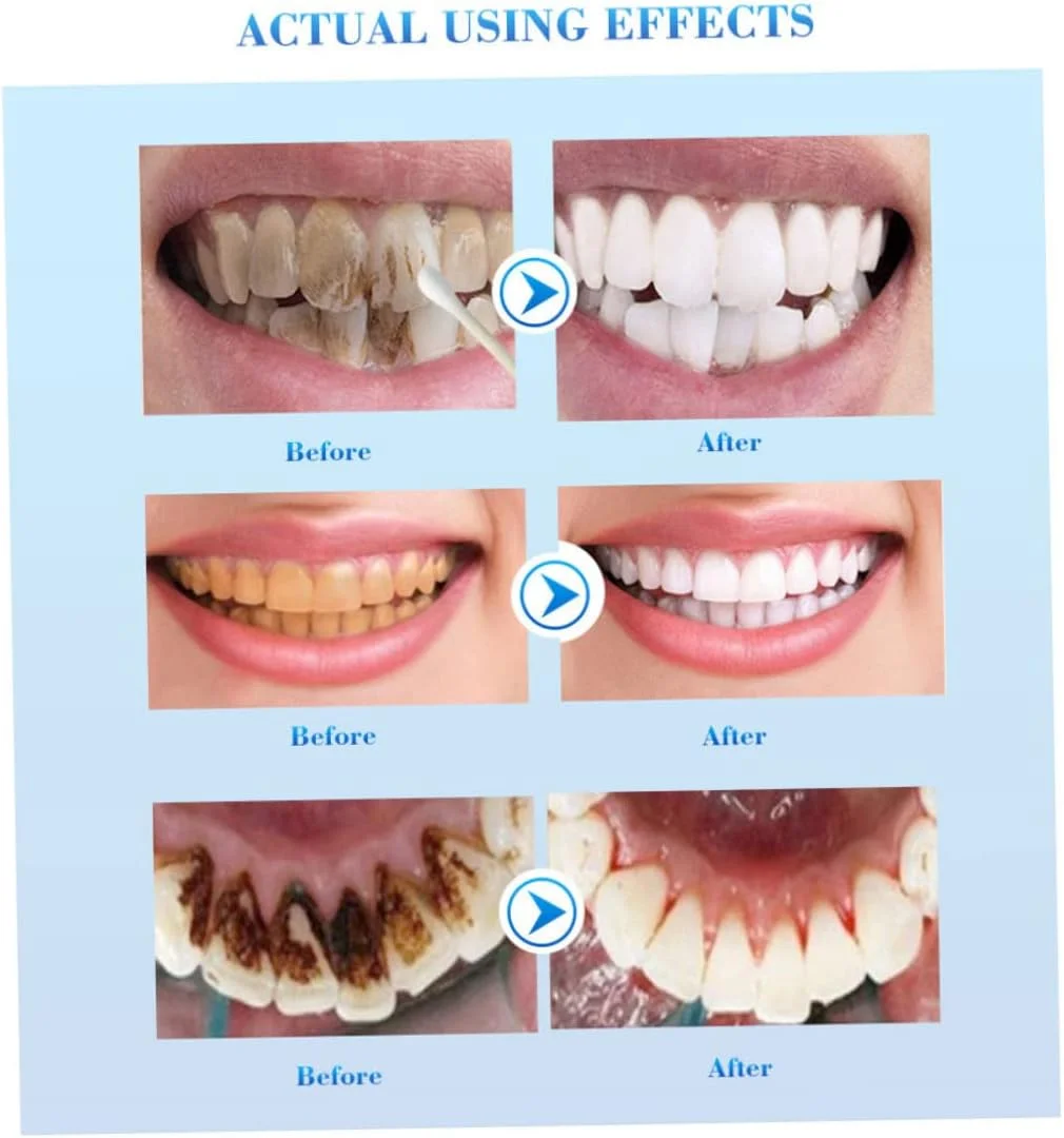 مجموعه لوازم آرایشی اسانس سفید کننده دندان EFERO سرم پاک کننده دندان بهداشت دهان و دندان از بین برنده لکه های پلاک 10 میلی لیتر