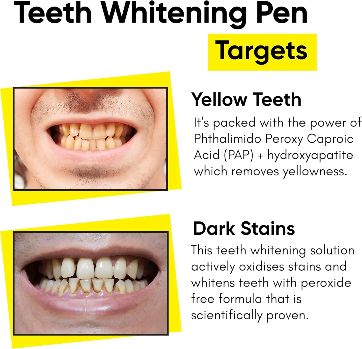 قلم سفید کننده دندان Masofta برای از بین بردن لکه های زرد و تیره با PAP+، بدون پراکسید و بدون ایجاد حساسیت - 2 میلی لیتر قلم سفید کننده دندان Masofta برای از بین بردن لکه های زرد و تیره با PAP+، بدون پراکسید و بدون ایجاد حساسیت - 2 میلی لیتر