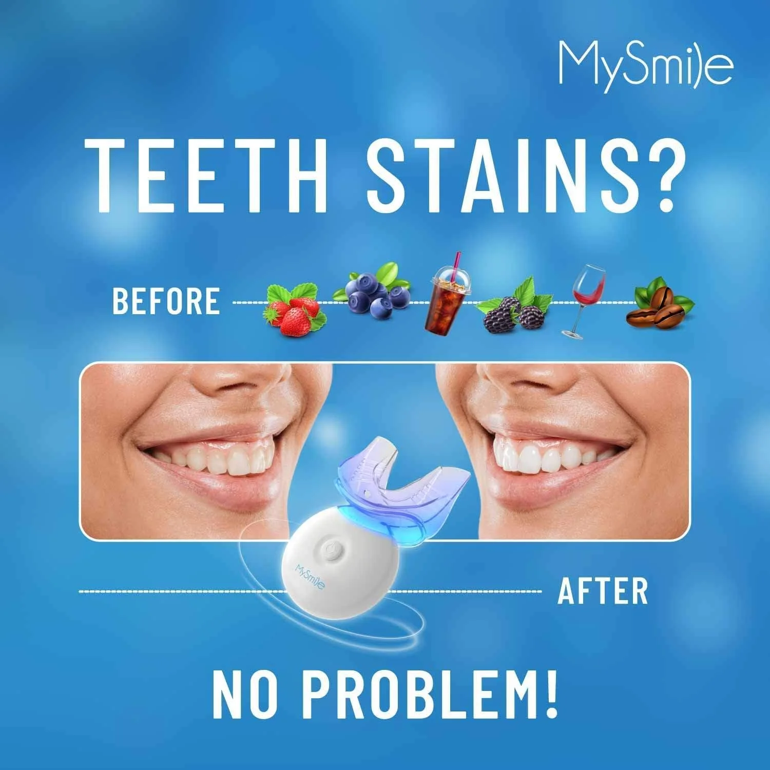 کیت سفید کننده دندان MySmile با نور LED، سفید کننده سریع دندان غیر حساس 10 دقیقه ای با 3 ژل سفید کننده دندان کاربامید پراکسید، کمک به از بین بردن لکه های ناشی از قهوه، نوشیدنی، نوشابه و غذا کیت سفید کننده دندان MySmile با نور LED، سفید کننده سریع دندان غیر حساس 10 دقیقه ای با 3 ژل سفید کننده دندان کاربامید پراکسید، کمک به از بین بردن لکه های ناشی از قهوه، نوشیدنی، نوشابه و غذا