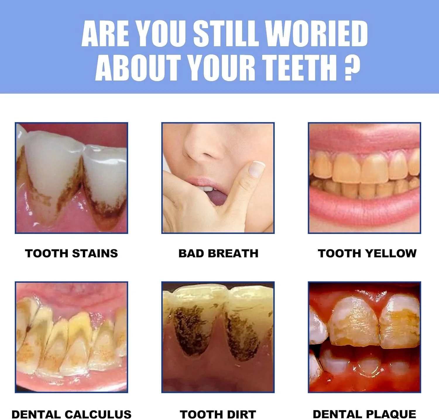 پودر دندان Miyanxi، پودر سفید کننده دندان، پودر سفید کننده دندان برای سفید کردن دندان، پودر دندان Miyanxi از بین برنده لکه، از بین برنده موثر لکه ها، حفظ تازگی دهان (4 عدد)
