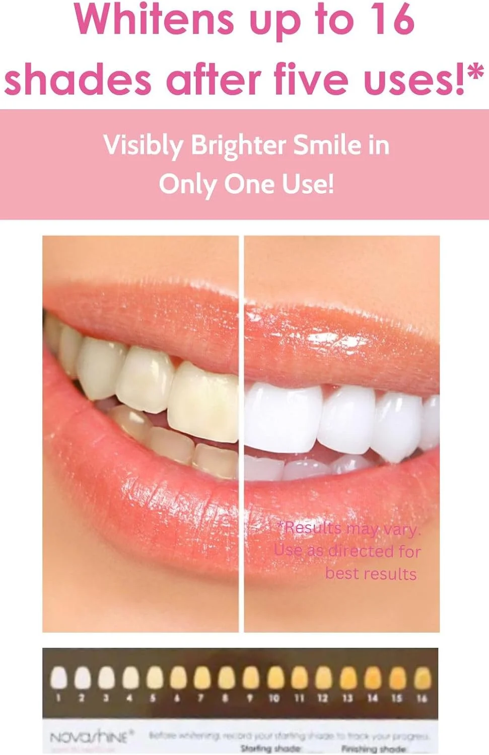 کیت سفید کننده دندان نواشاین با نور آبی LED پیشرفته