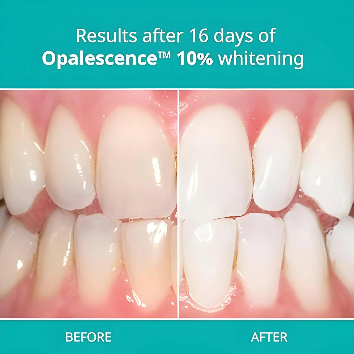 سفید کننده دندان Opalescence PF 10% بسته 4 عددی با طعم ملون