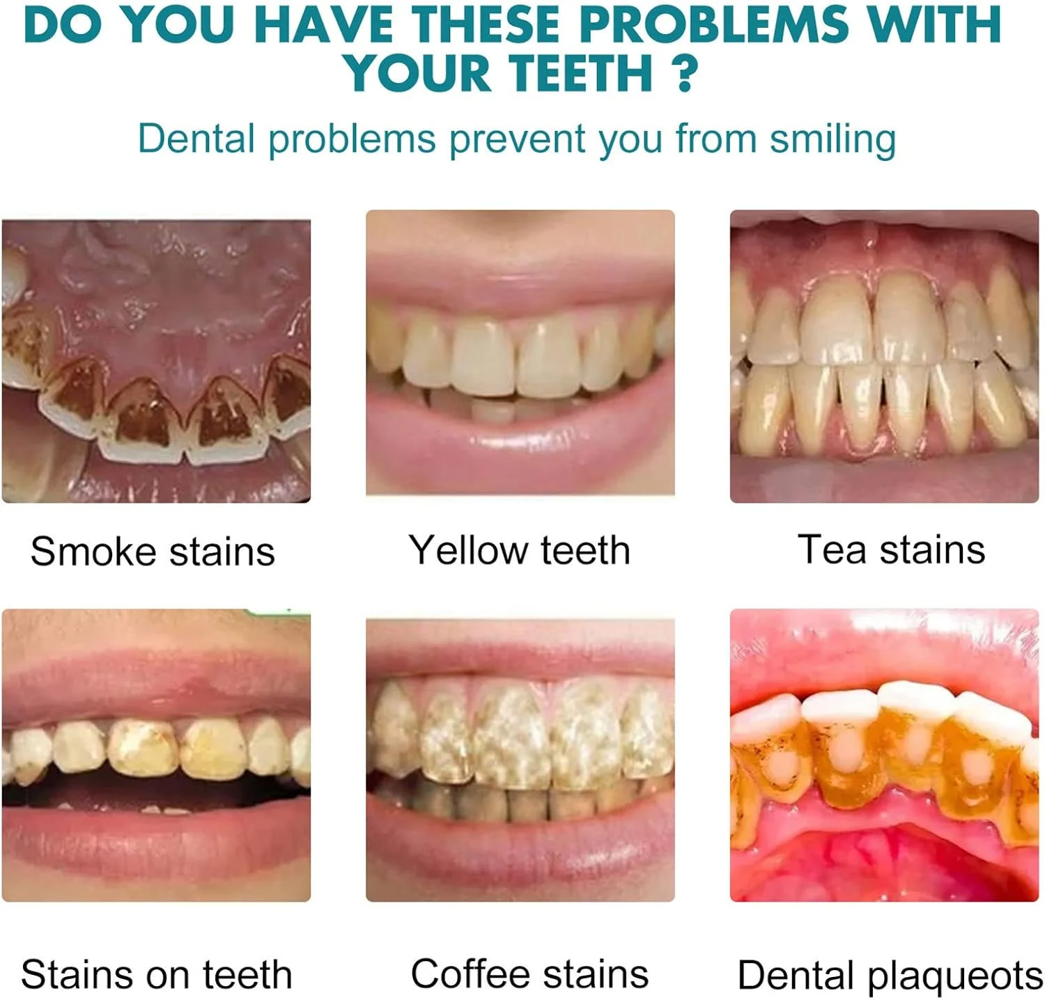 لاک سفید کننده فوری دندان اونا 15 میلی لیتر، از بین برنده لکه ها، خوشبو کننده دهان، بدون ایجاد حساسیت، نتایج سریع، مراقبت از دهان لاک سفید کننده فوری دندان اونا 15 میلی لیتر، از بین برنده لکه ها، خوشبو کننده دهان، بدون ایجاد حساسیت، نتایج سریع، مراقبت از دهان