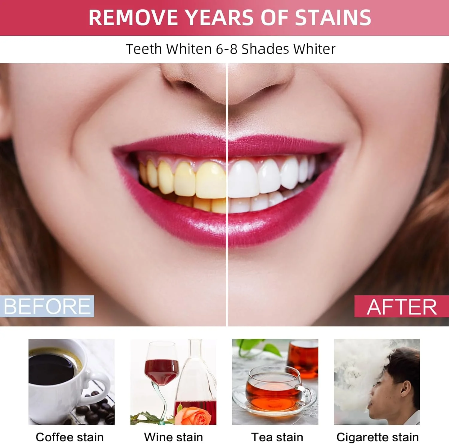 کیت سفید کننده دندان Pdoo با نور LED برای دندان های حساس، سفید کننده سریع در خانه، ژل سفید کننده دندان به از بین بردن انواع لکه ها کمک می کند کیت سفید کننده دندان Pdoo با نور LED برای دندان های حساس، سفید کننده سریع در خانه، ژل سفید کننده دندان به از بین بردن انواع لکه ها کمک می کند