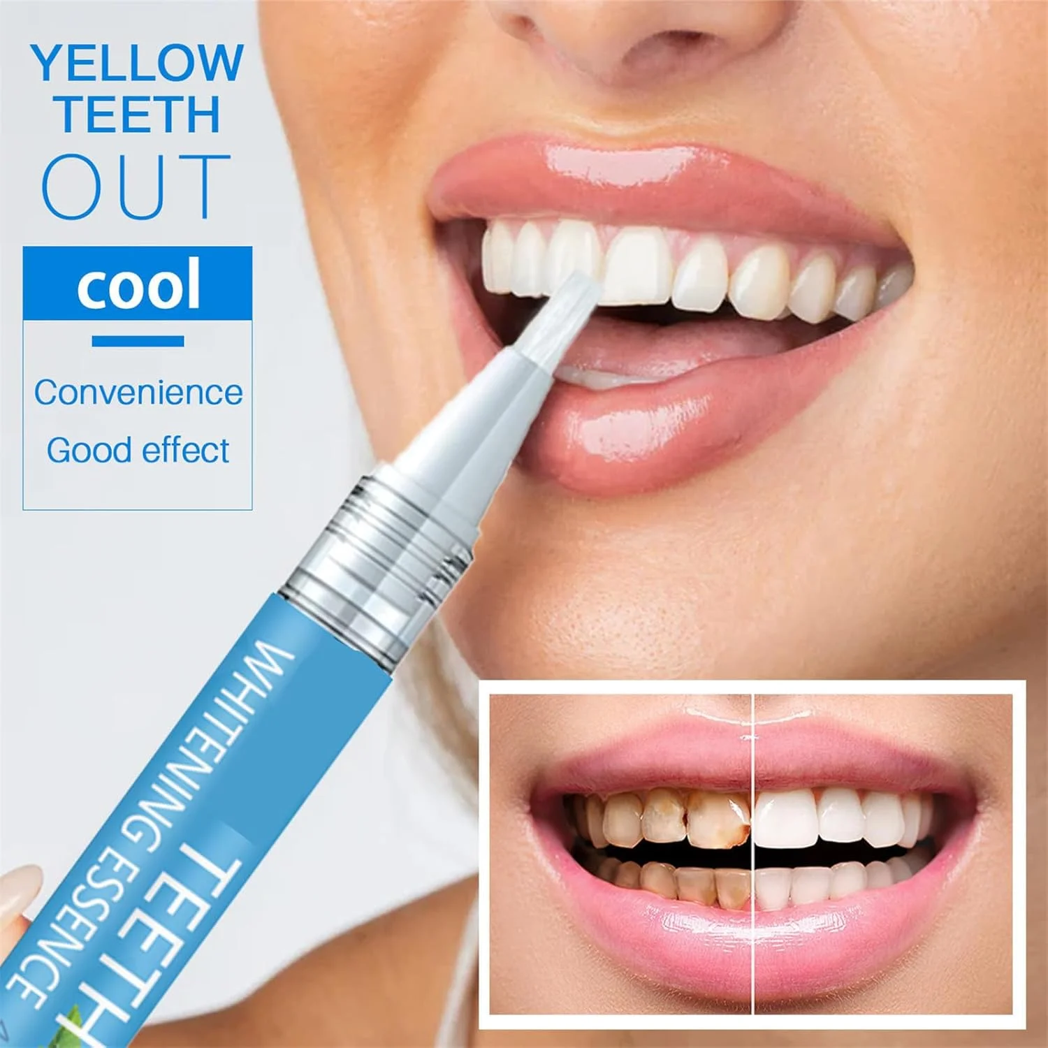 قلم سفید کننده دندان PINKE، ژل نعناع، ​​از بین برنده سریع لکه، ملایم و راحت، 2 عدد