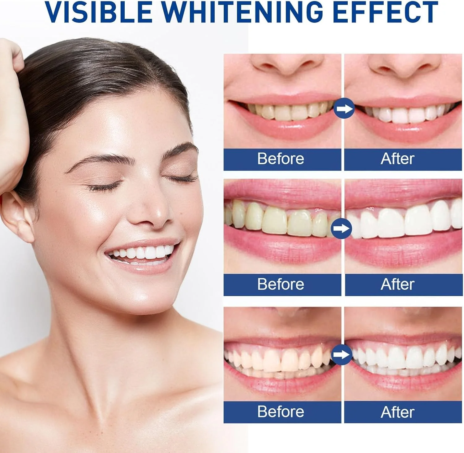 کیت سفید کننده دندان PINKE، ژل نعناع، 4 عدد، از بین برنده لکه دندان، فرمول ملایم و طبیعی، سفید کننده سریع، بدون حساسیت، استفاده آسان، مناسب برای مسافرت، کیفیت حرفه ای کیت سفید کننده دندان PINKE، ژل نعناع، 4 عدد، از بین برنده لکه دندان، فرمول ملایم و طبیعی، سفید کننده سریع، بدون حساسیت، استفاده آسان، مناسب برای مسافرت، کیفیت حرفه ای