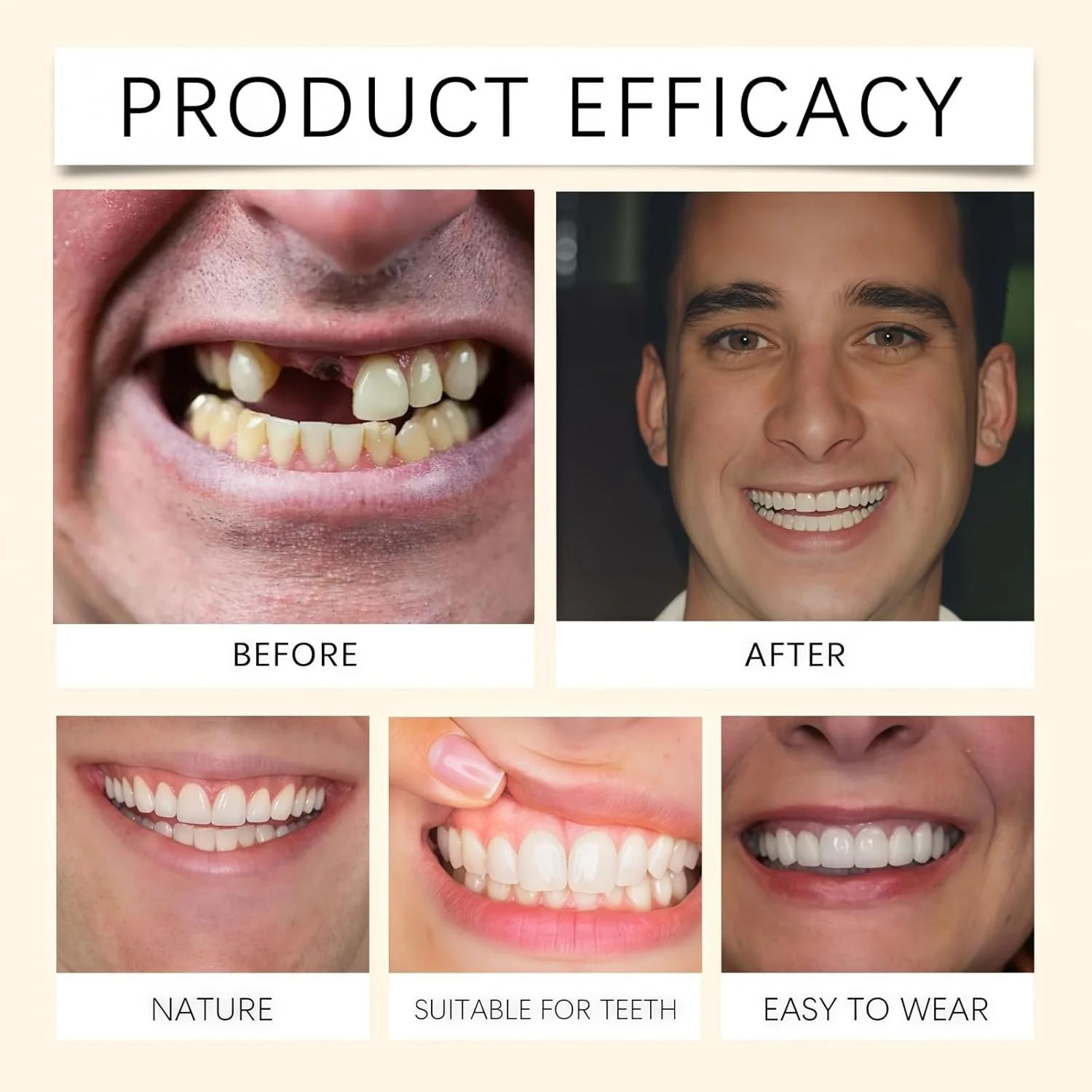 ست دندان مصنوعی سیلیکونی، ست دندان های مصنوعی نرم، روکش دندان های مصنوعی بالا و پایین، روکش گیره ای دندان، دندان مصنوعی بالا و پایین ست هماهنگ، دندان مصنوعی راحت و طبیعی ست دندان مصنوعی سیلیکونی، ست دندان های مصنوعی نرم، روکش دندان های مصنوعی بالا و پایین، روکش گیره ای دندان، دندان مصنوعی بالا و پایین ست هماهنگ، دندان مصنوعی راحت و طبیعی