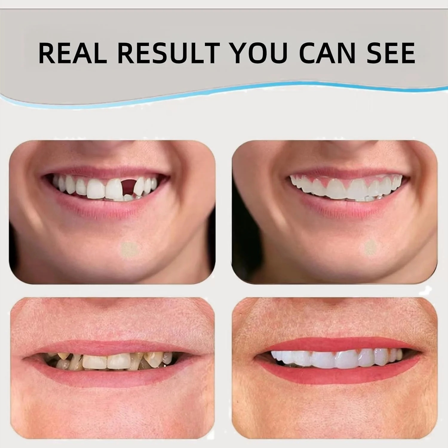 ست دندان مصنوعی سیلیکونی نرم، مجموعه دندان های مصنوعی بالا و پایین، دندان های مصنوعی راحت و طبیعی، آستر موقت دندان، دندان های مصنوعی قالب گیری شده، دندان مصنوعی برای افراد بدون دندان، دندان مصنوعی سیلیکونی کامل دهان ست دندان مصنوعی سیلیکونی نرم، مجموعه دندان های مصنوعی بالا و پایین، دندان های مصنوعی راحت و طبیعی، آستر موقت دندان، دندان های مصنوعی قالب گیری شده، دندان مصنوعی برای افراد بدون دندان، دندان مصنوعی سیلیکونی کامل دهان