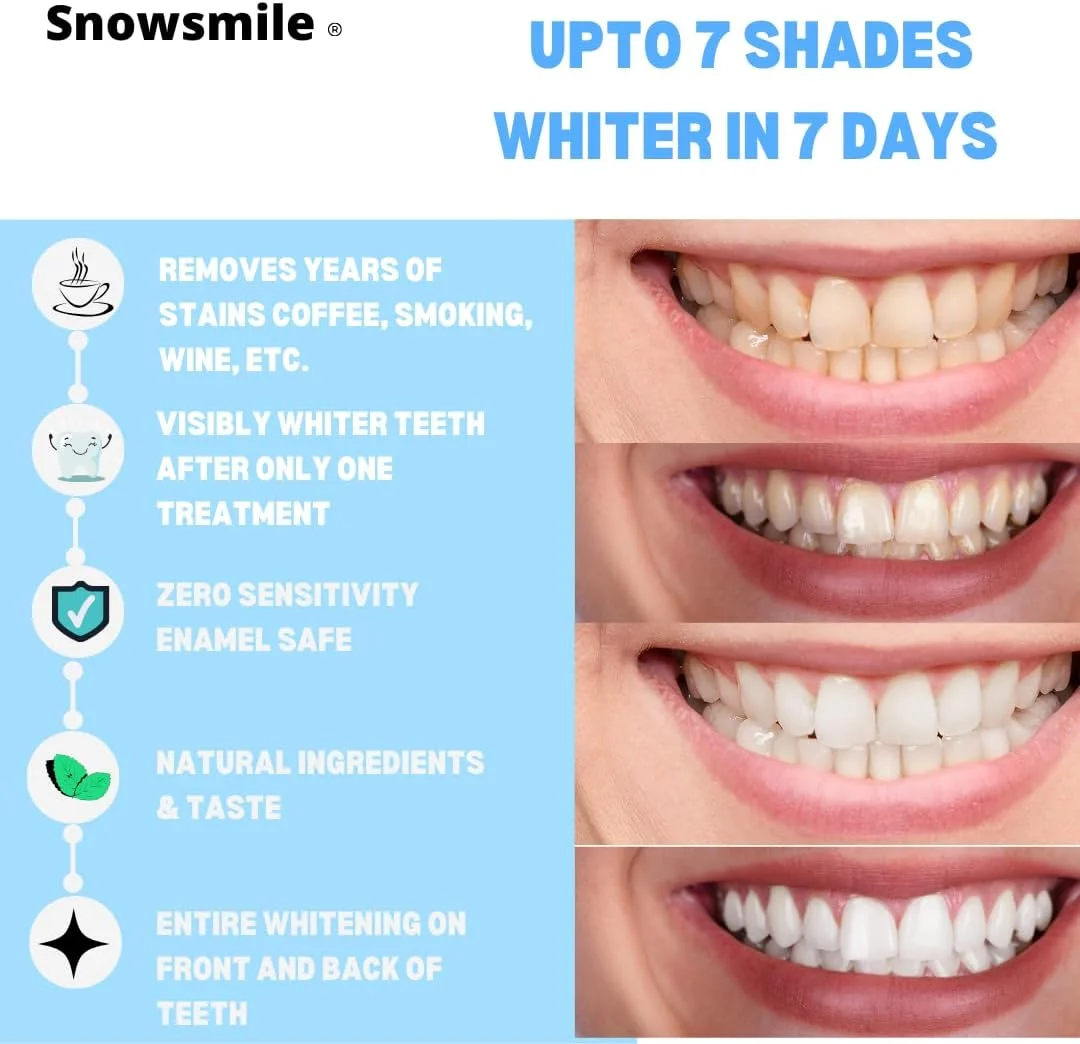 نوارهای سفید کننده دندان پریمیوم Snowsmile، ۱۴ نوار، ۷ دوره درمان نوارهای سفید کننده دندان پریمیوم Snowsmile، ۱۴ نوار، ۷ دوره درمان