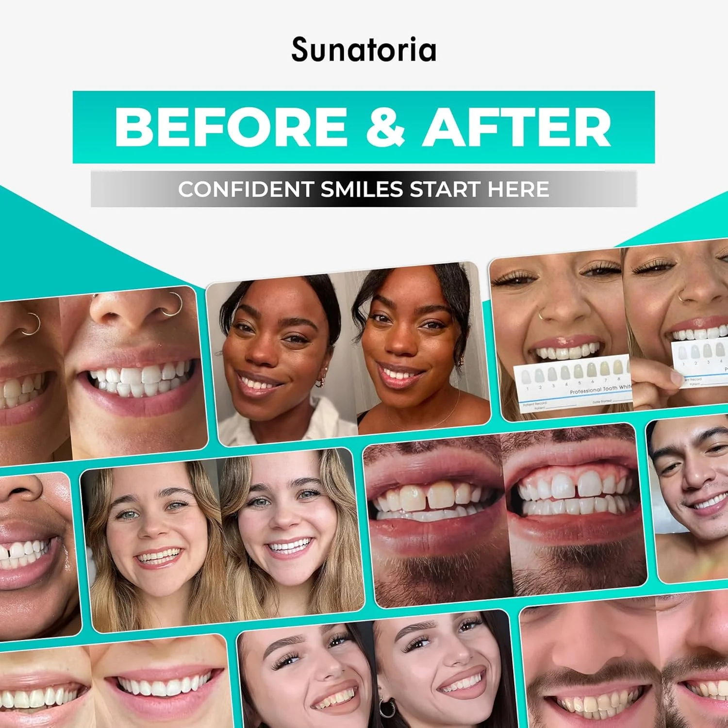 پودر سفید کننده دندان زغال فعال SUNATORIA - فرمول بهبود یافته - سفید کننده دندان نارگیلی - پاک کننده موثر لکه های دندان برای لبخندی سفیدتر و سالم تر - محصول انگلستان پودر سفید کننده دندان زغال فعال SUNATORIA - فرمول بهبود یافته - سفید کننده دندان نارگیلی - پاک کننده موثر لکه های دندان برای لبخندی سفیدتر و سالم تر - محصول انگلستان