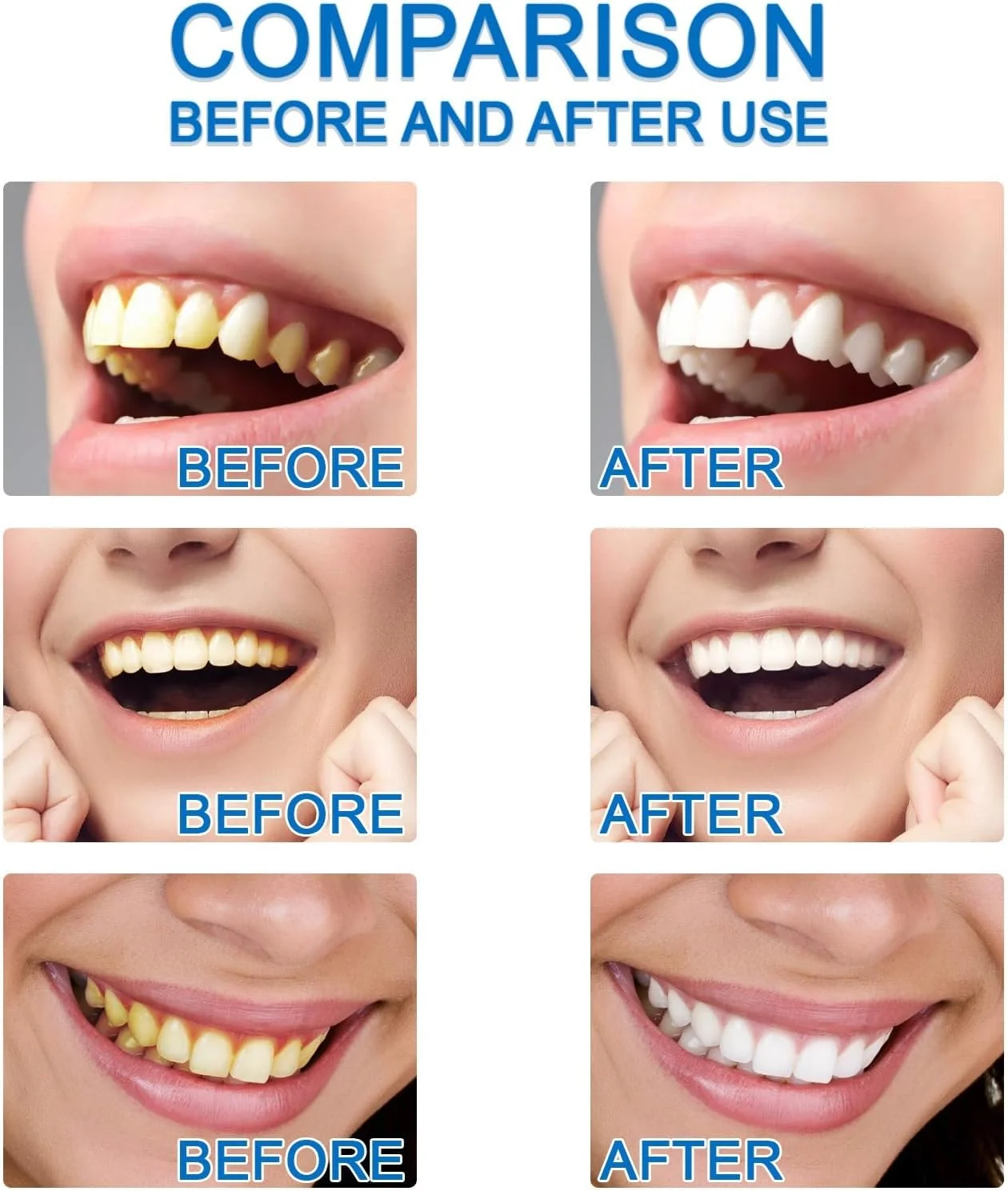 لاک سفید کننده دندان برای نتایج فوری لاک سفید کننده دندان برای نتایج فوری