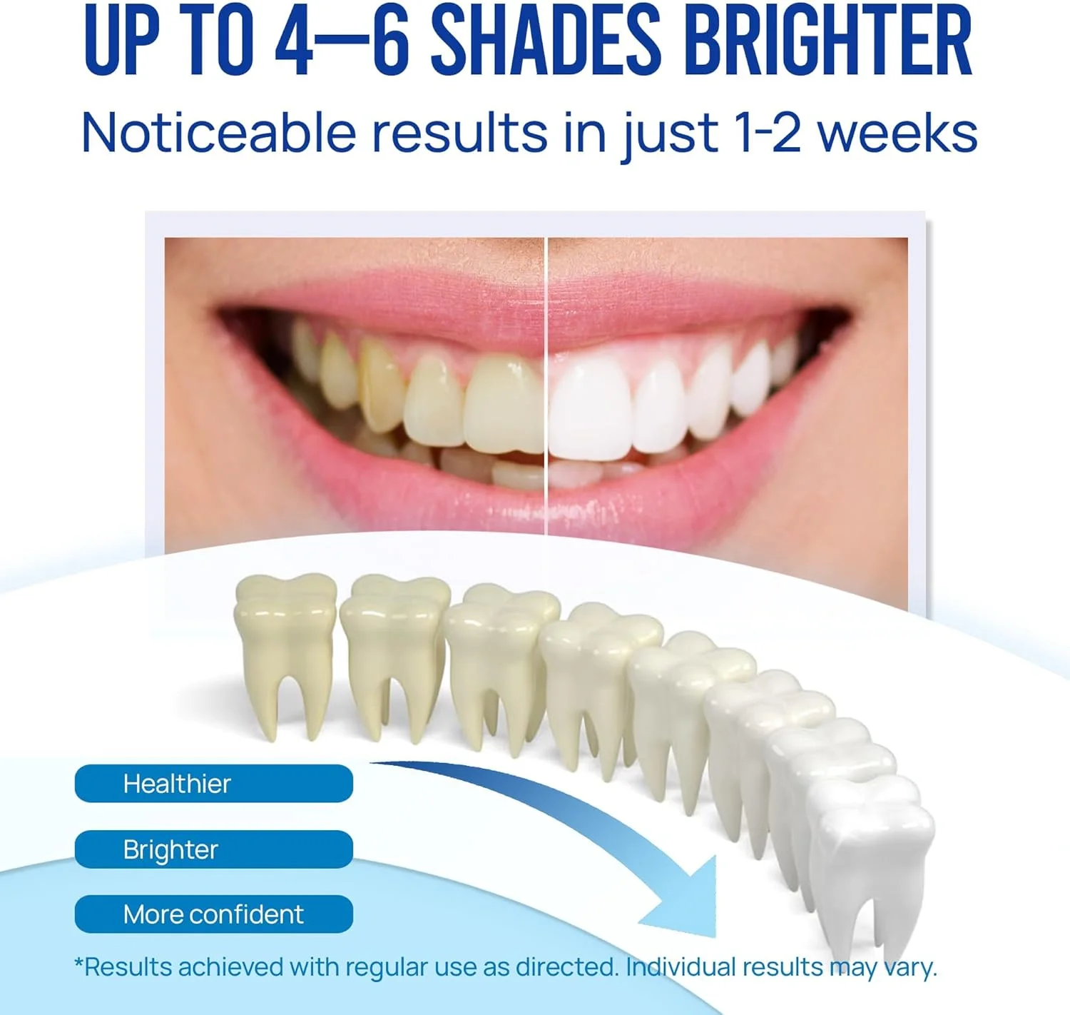 کیت ژل قلم سفید کننده دندان: ژل 35% کاربامید پراکسید برای از بین بردن لکه ها - بدون حساسیت با قلم معدنی کننده برای لبخندی روشن تر و سفیدتر با طعم نعناع (بسته 5 عددی)