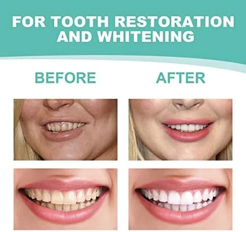 3 جفت روکش دندانی فوری برای مردان و زنان، پوشش موقت دندان برای پنهان کردن نواقص، بدون درد، بدون تزریق، بدون تراشیدن، راه حلی مطمئن، سفید 3 جفت روکش دندانی فوری برای مردان و زنان، پوشش موقت دندان برای پنهان کردن نواقص، بدون درد، بدون تزریق، بدون تراشیدن، راه حلی مطمئن، سفید