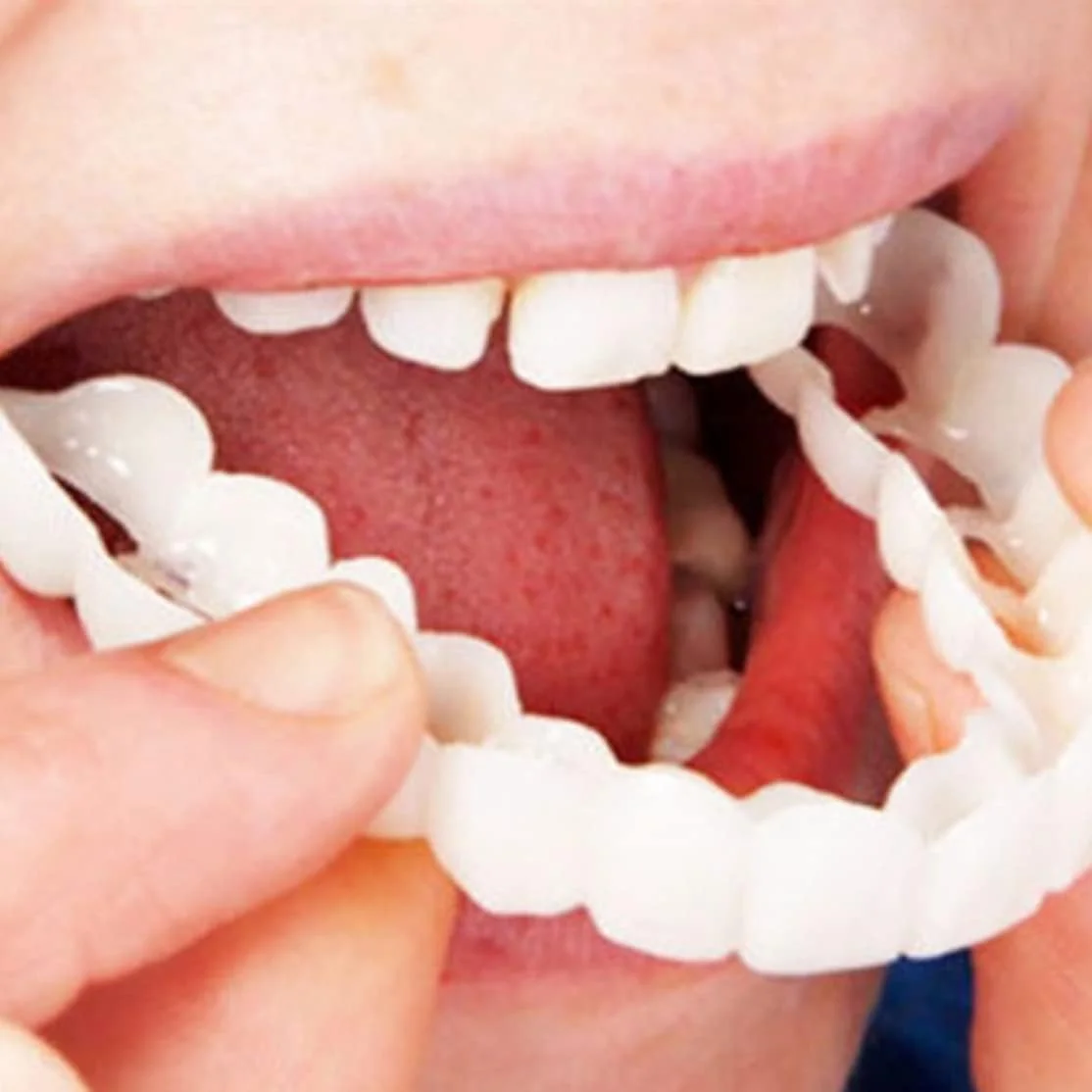 دندان مصنوعی موقت روکش دندان، دندان های فوری سفید کننده برای مردان و زنان، جایگزینی برای سفید کردن دندان های بد