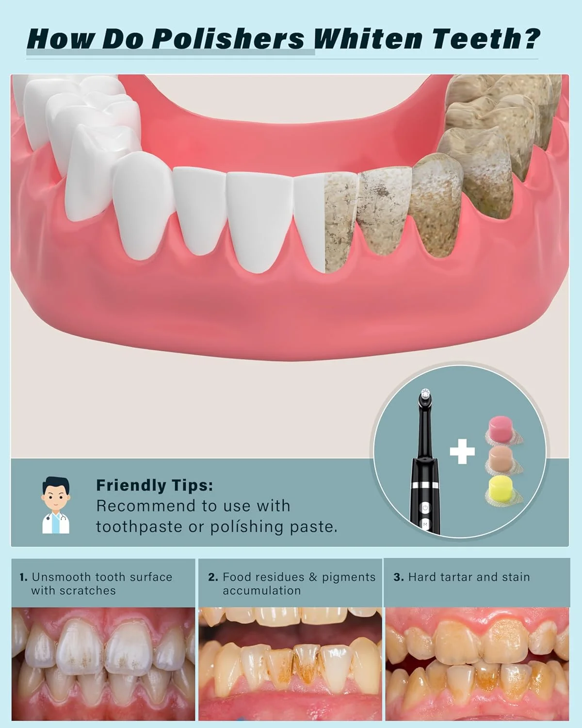 دستگاه پولیش دندان Trueocity، کیت سفید کننده دندان با 5 حالت برای از بین بردن لکه های پلاک و زردی دندان، دستگاه پولیش لکه دندان با 5 سری و 3 خمیر پولیش، ابزار پلاک دندان، قابل شارژ