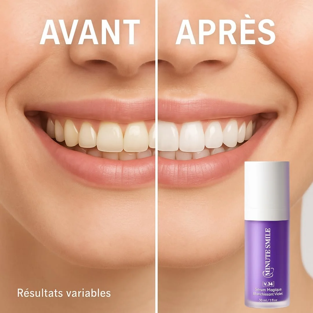 سرم خمیر دندان V34، سرم V34، سفید کننده دندان، اصلاح رنگ دندان، سرم اصلاح رنگ، برای دندان های حساس، لبخند فوری سرم خمیر دندان V34، سرم V34، سفید کننده دندان، اصلاح رنگ دندان، سرم اصلاح رنگ، برای دندان های حساس، لبخند فوری