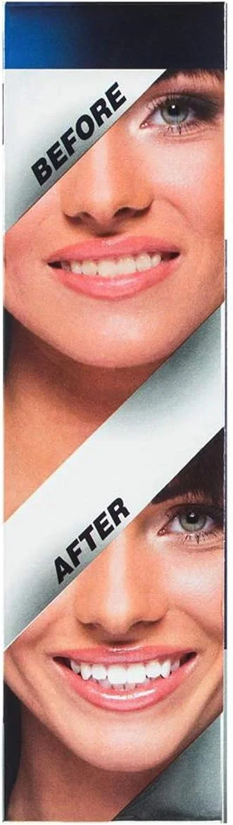 کیت سفید کننده حرفه ای دندان وایت گلو با نور ال ای دی برای دندان ها و لثه های حساس - ژل فعال شده با نور آبی برای بهترین نتیجه سفید کنندگی دندان - تایمر 10 دقیقه ای و 50 بار استفاده!